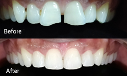 Cosmetic Dentistry